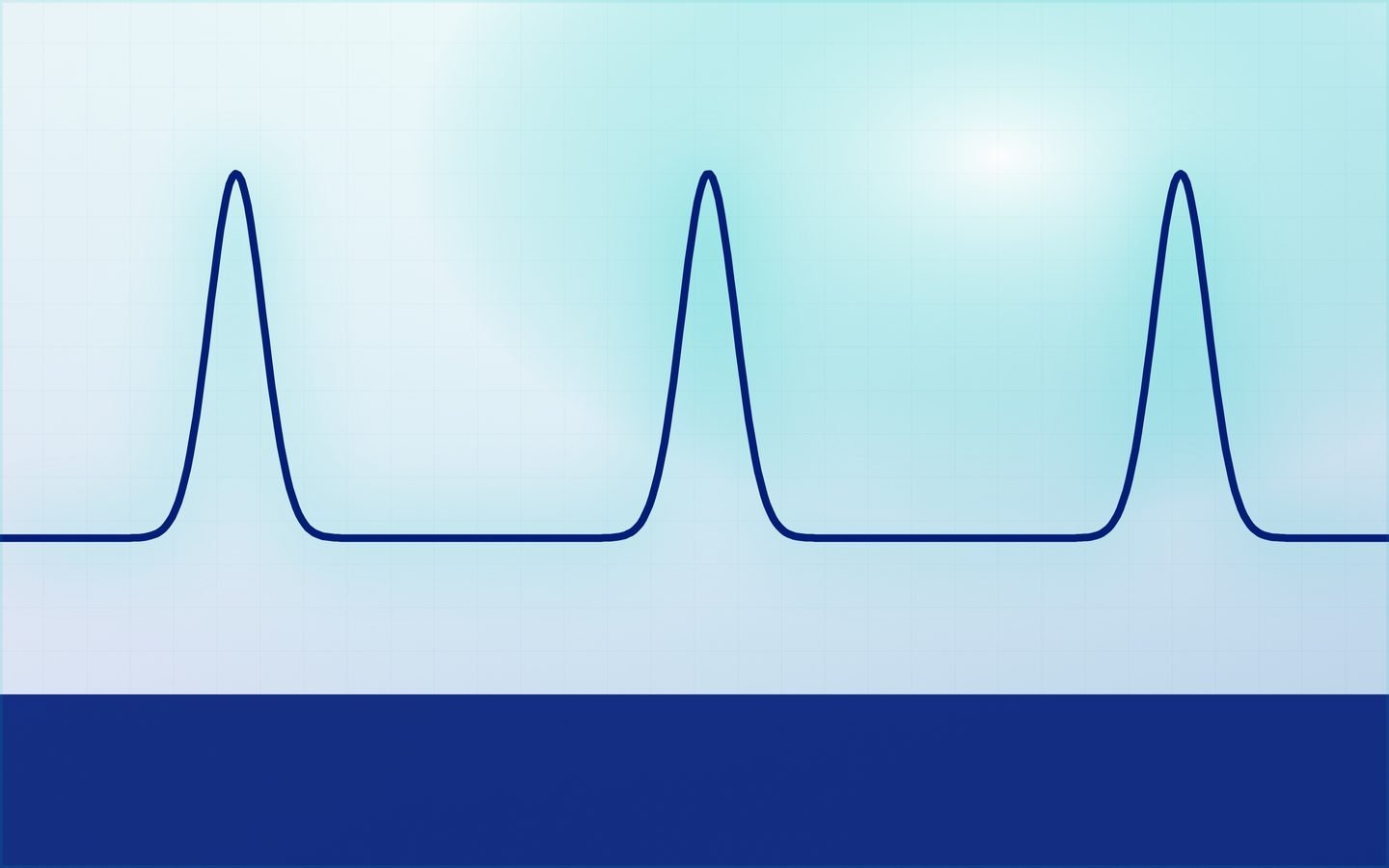 Cardiac diagnostics